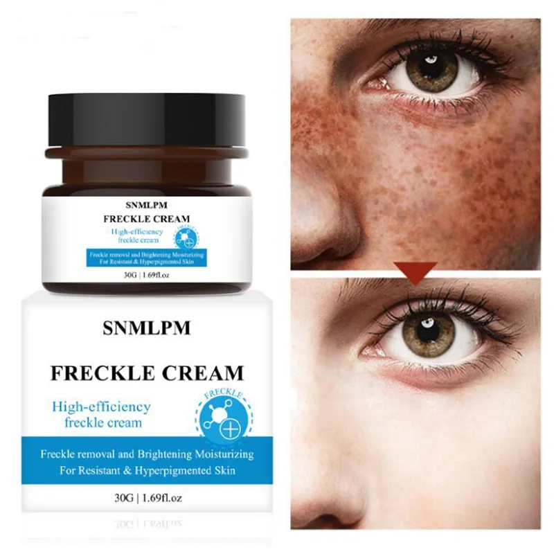 

30g Powerful Whitening Freckle Cream Chinese Herbal Plant Face Cream Remove Freckles and Dark Spots Skin Whitening Cream