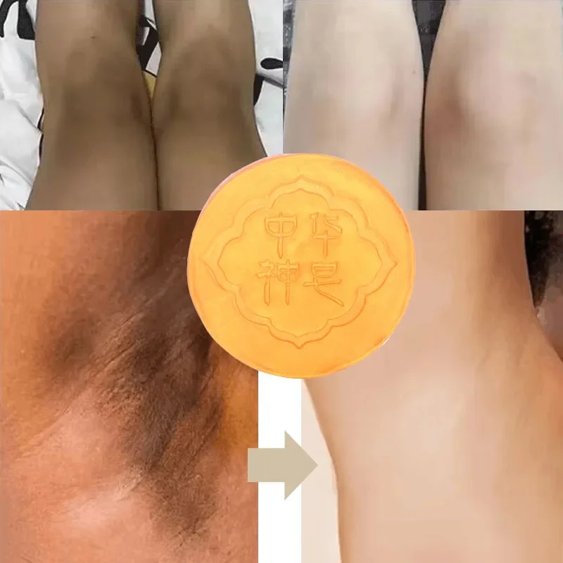 Отбеливающее мыло для тела