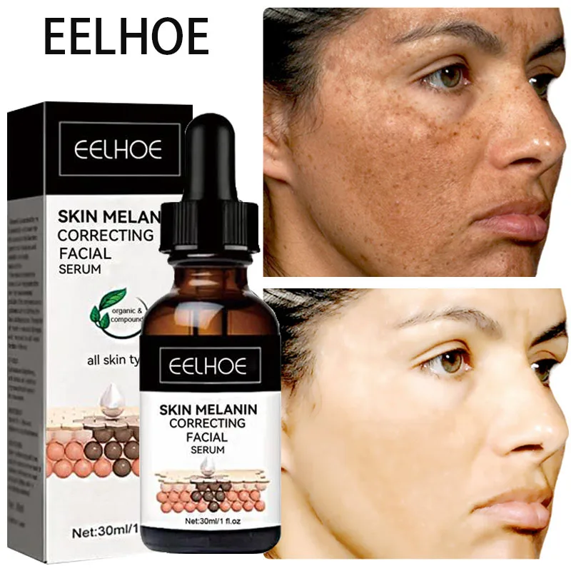 

Dark Spot Remover for Face Whitening Lighten Freckle Chloasma Senile Plaques Sunburn Cyasma Cream Melanin Correcting Skin Care