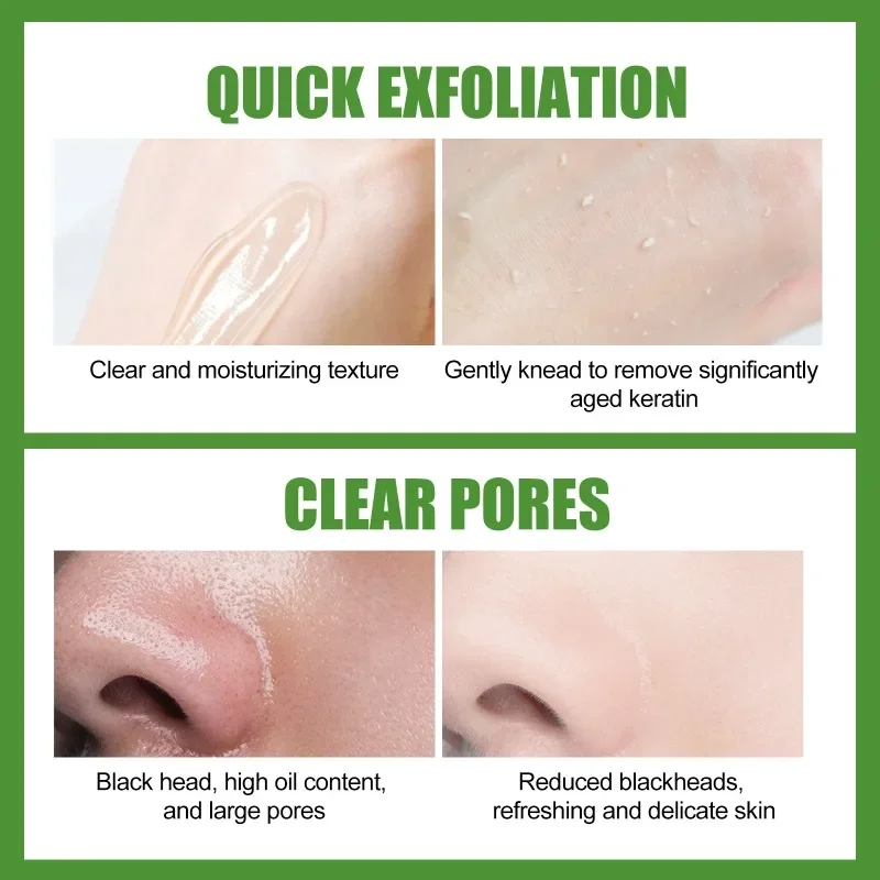 Эффективный Отшелушивающий гель для лица с алоэ увлажняет глубокое очищение