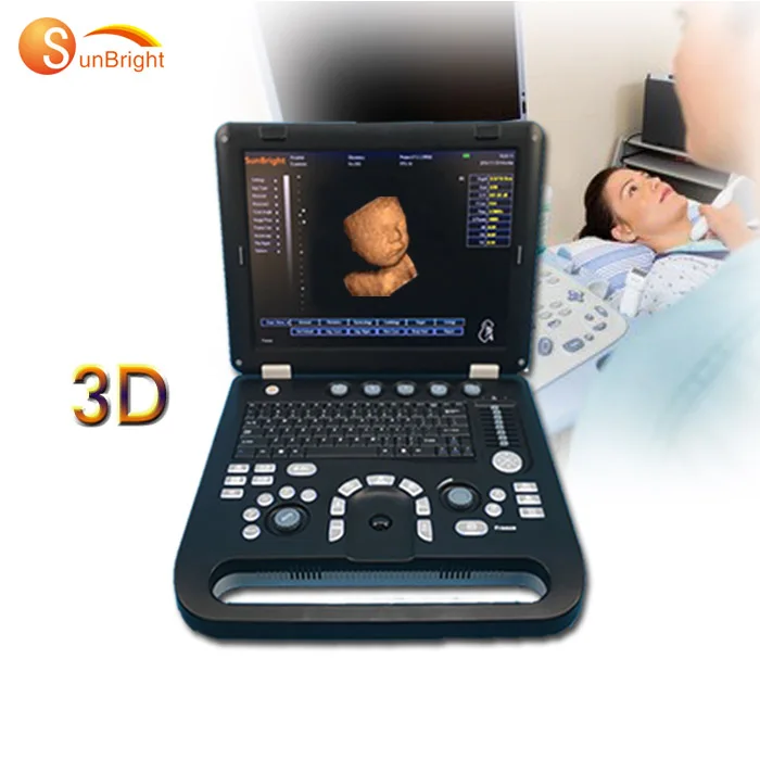 

high quality 3D digital laptop pelvic ultrasound machine SUN-800D
