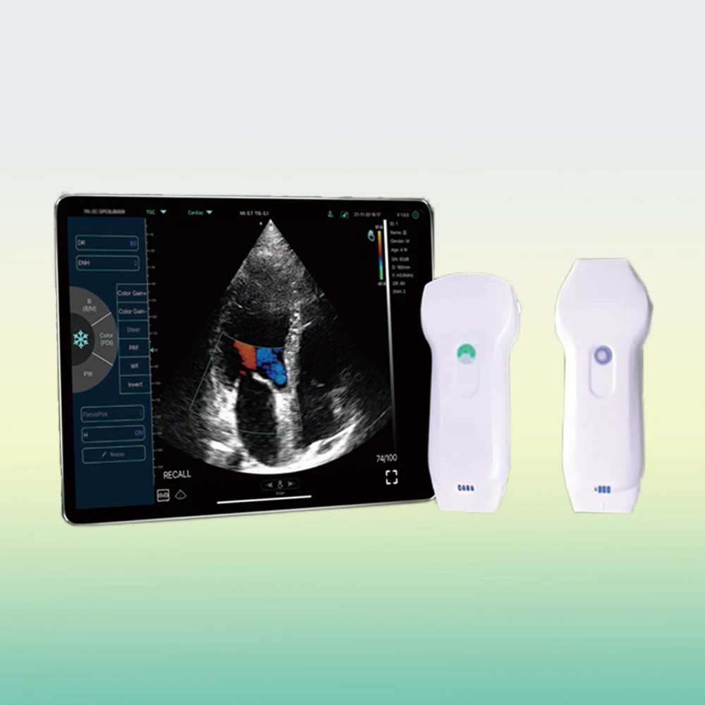 

Color Doppler Wireless Probe 128 elements 3 in 1 Convex/Linear/Phased Probe Transducer Double Head
