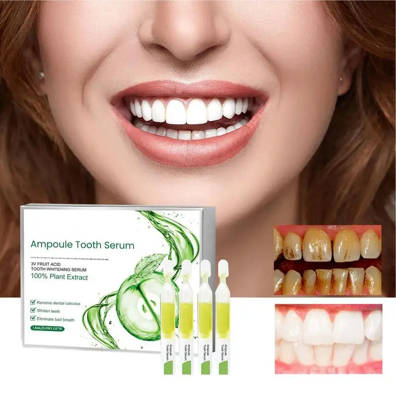 

10pcs Stain Removal Toothpaste Whitenings Toothpaste For Bad Breath Control Sensitive Teeth Oral Care Gums And Teeth Care