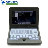 portable laptop style medical 4d ultrasound scanning machine for hospitals