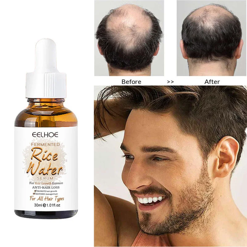

Hair Growth Serum Anti-Hair Loss Repair Product Fast Growing Nourishing Scalp Thicker Repair Damage Dry Frizzy Care Essence 30ml
