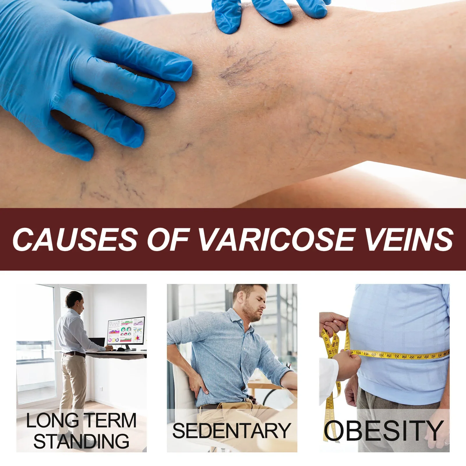 Мазь от варикозного расширения вен премиум-класса