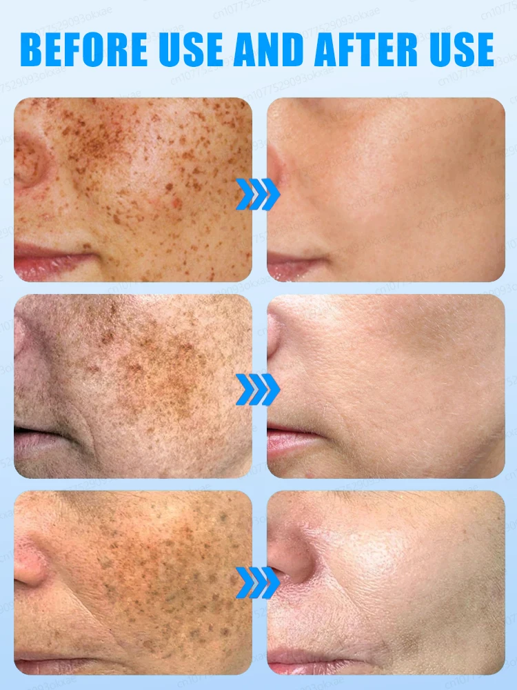 Рисунок 2 - Средство для удаления темных точек на лице