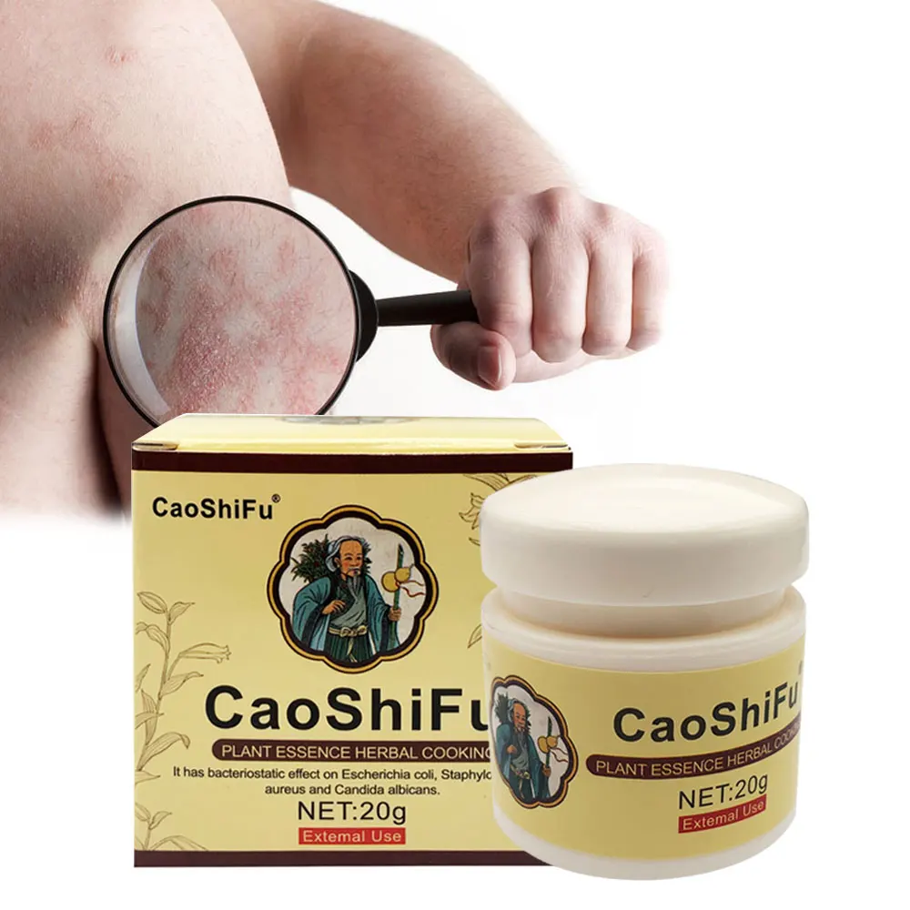 20 г мазь CAOSHIFU от псориаза для проблем на коже крем противозудный медицинский