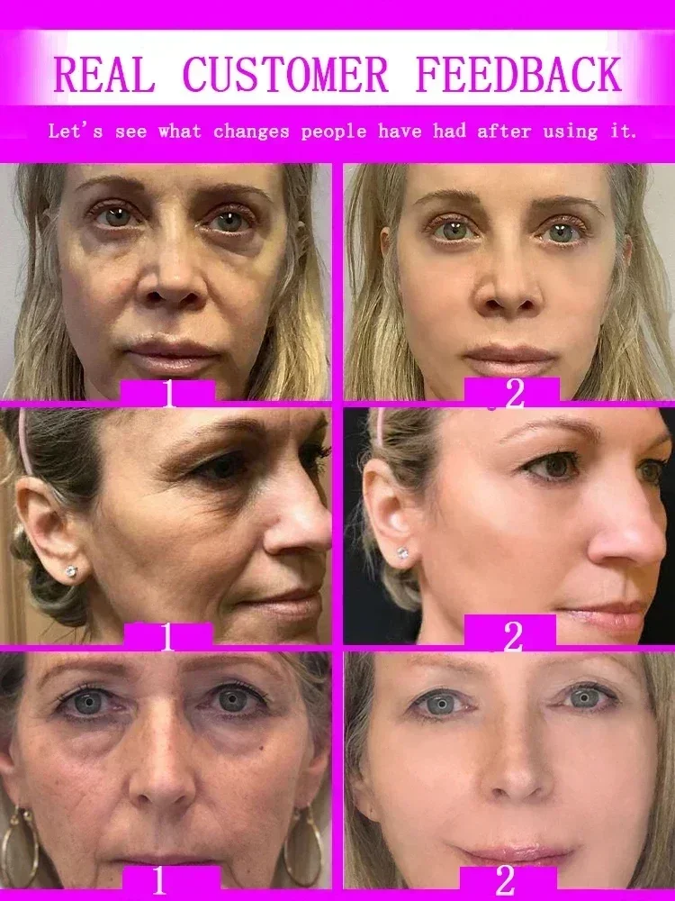 Мгновенный эффект против морщин и старения удаление выцветание тонкие линии