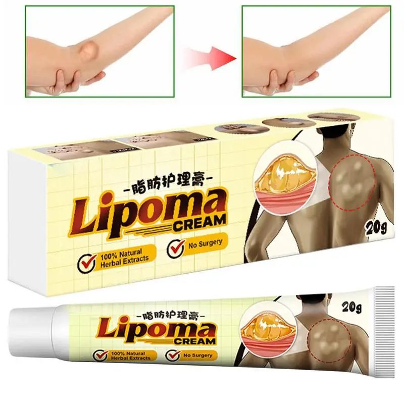 

Lipoma травяной крем, ингредиенты Lipoma Lumps, мазь для удаления, легко впитывает Lipoma Lumps, быстрое облегчение дискомфорта