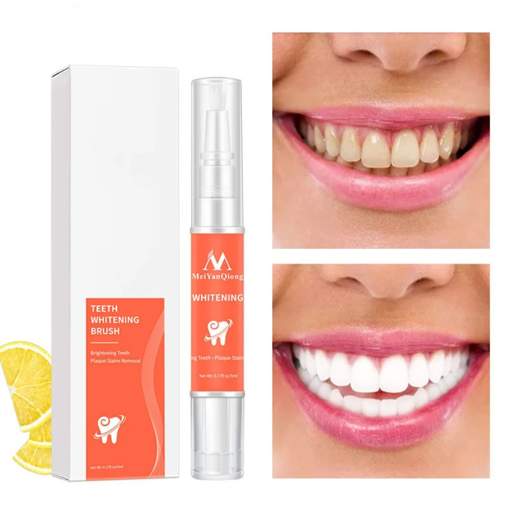 Ручка для отбеливания зубов удаляет зубной налет пятна отбеливание чистящая