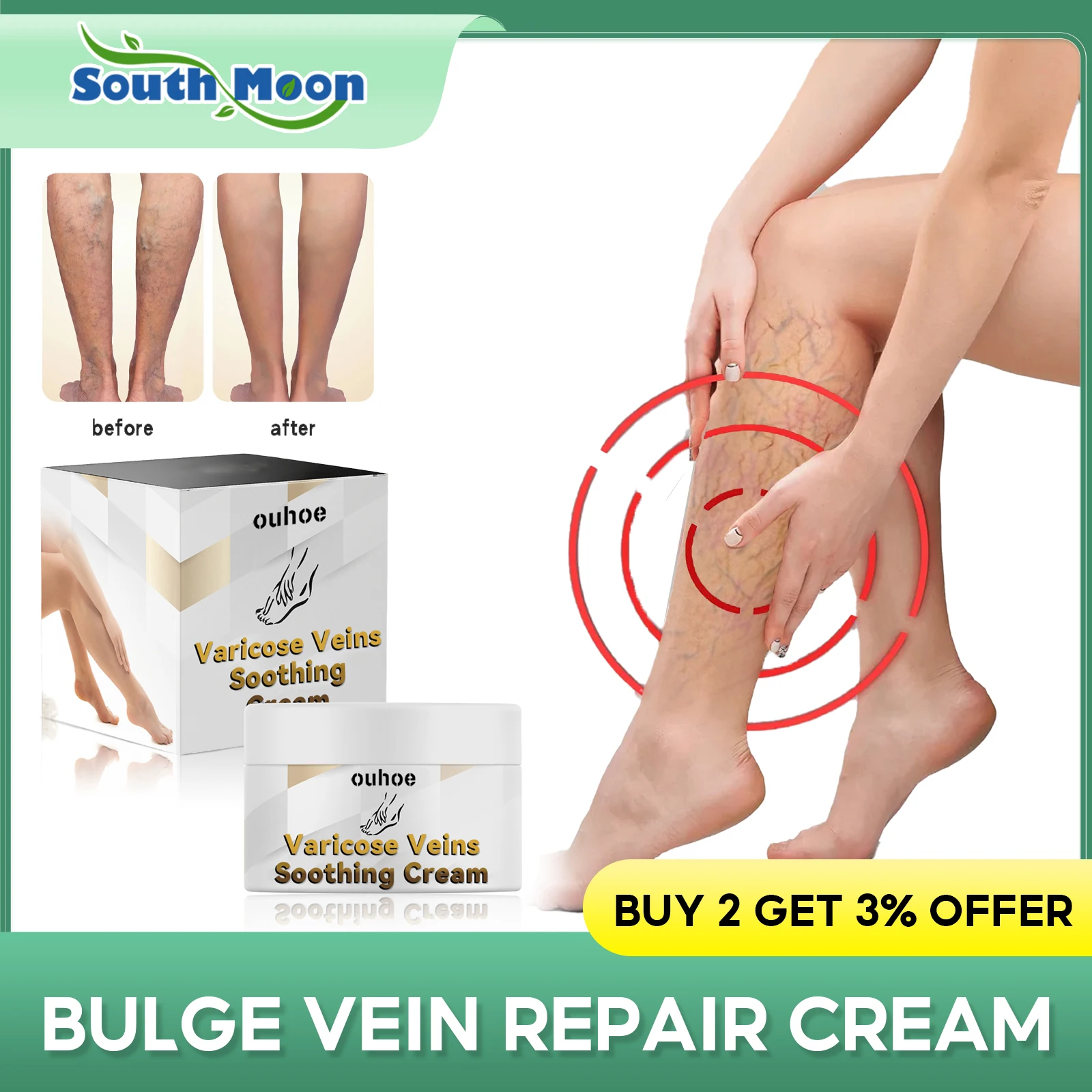 

Varicosity Treatment Cream Varicose Veins Repair Angiitis Pain Relief Vasculitis Earthworm Legs Swelling Anti Phlebitis Ointment