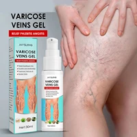 varicose vein repair varicose vein gel thoroughly relieves varicose leg bulge painful earthworm leg