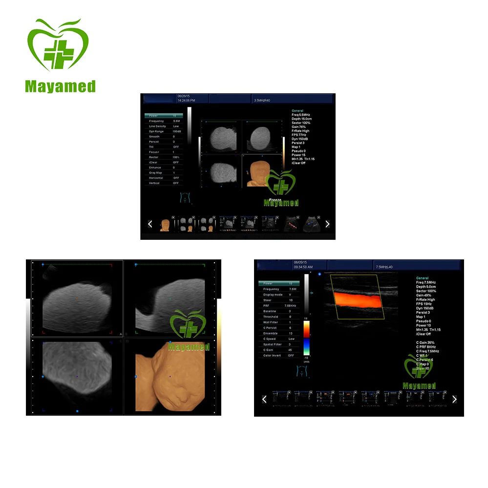 MY-A035A All цифровой портативный ультразвуковой допплер для беременных |