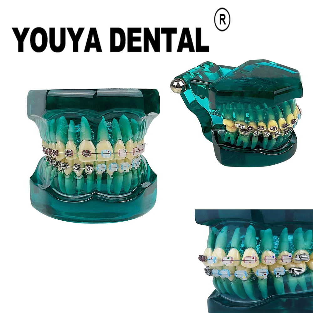 

Orthodontic Model with Metal&Ceramic&Self-locking Dental Teaching Model Doctor-patient Communication Tool Dentistry Equipment