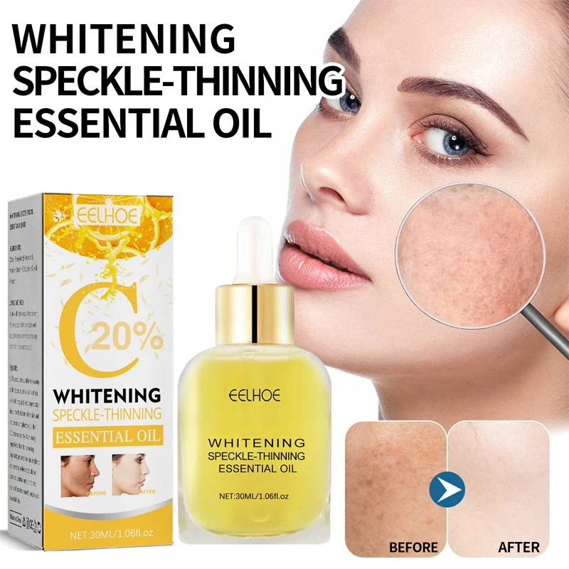 

Vitamin C Whitening Freckle Face Serum Fade Dark Spots Acne Melanin Pigment Moisturizing Brighten Nourish Essence Skin Care 30ml