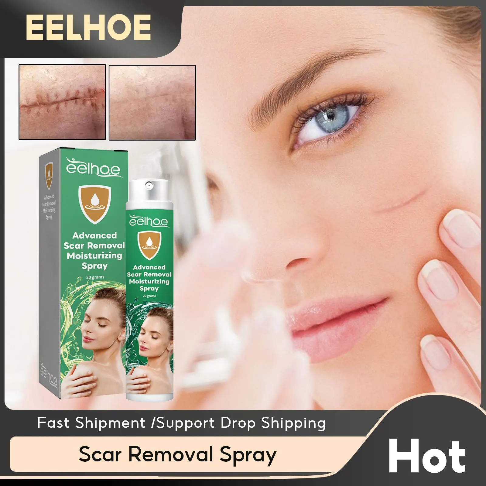 Крем для удаления шрамов спрей