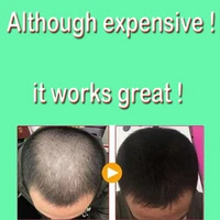 20ml hair care hair growth essential oils essence original 100 hair loss liquid health care beauty dense serum free shipping