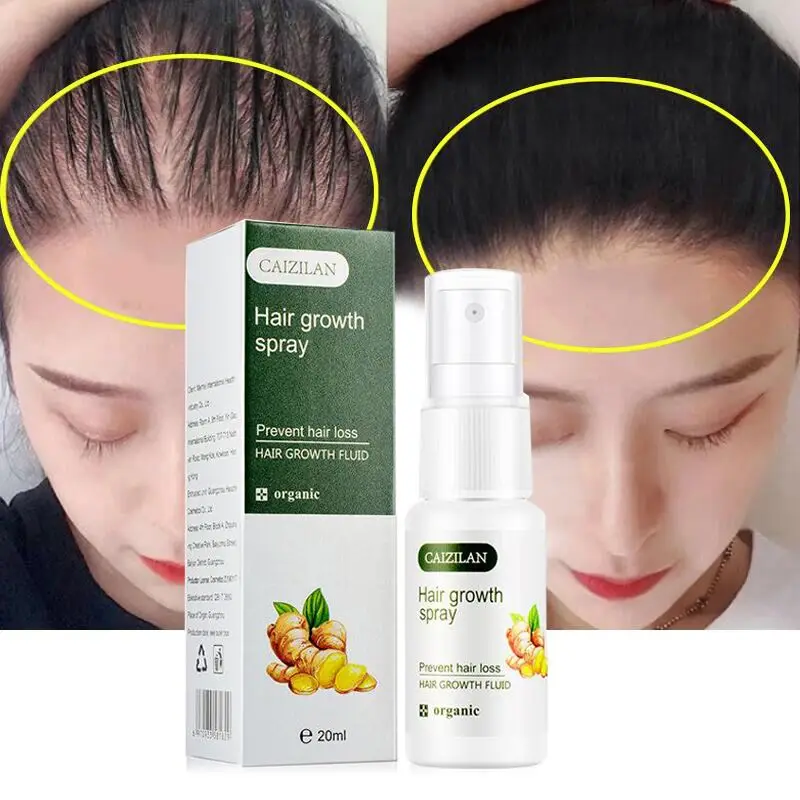 Имбирная сыворотка-спрей для роста волос натуральная Сыворотка против выпадения