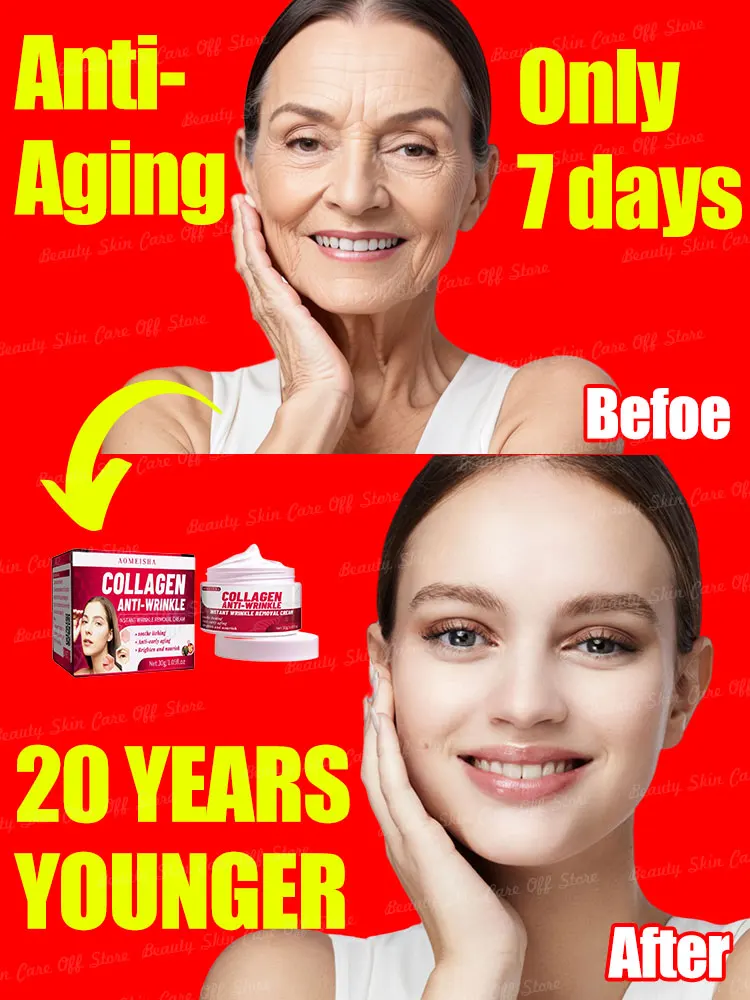 

Отбеливающий крем для веснушек, удаляет мелазму, осветляет, осветляет меланин, удаляет мелазму, увлажняет, против старения, уход за лицом