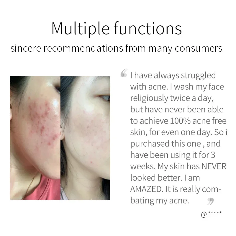 Рисунок 4 - Мыло с куркумой для очищения лица от акне