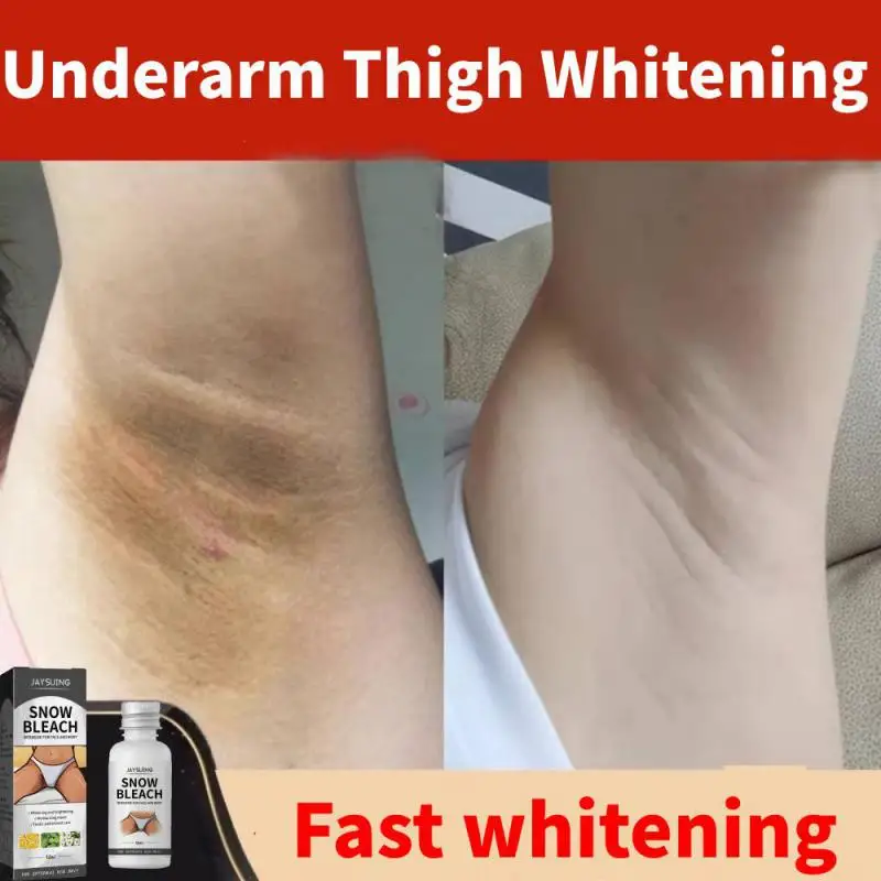 

Underarm Thigh Whitening Cream Private Parts Underarm Bleaching Serum Armpit Knees Elbows Neck Joint Under Armpit Whitening