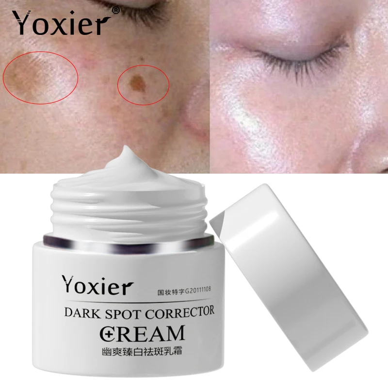 

Dark Spot Face Cream Corrector Anti-Aging Whitening Moisturizing Remove Sunburn Dark Spots and Acne Pigmentation Skin Care