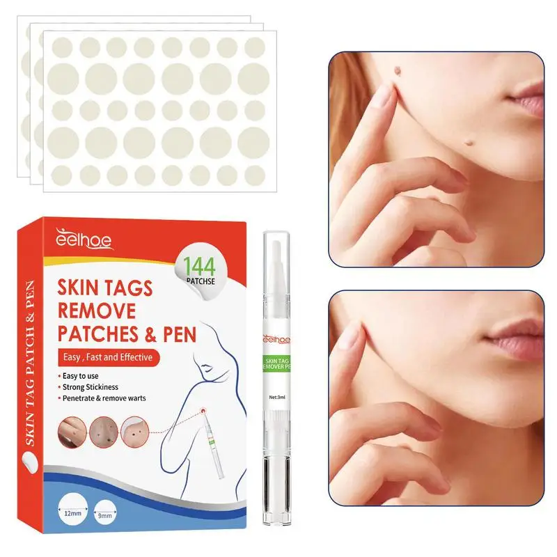 

Пластырь для удаления родинок, пятен, патчи, ручка для удаления родинок, прыщиков, пластыри для лица, легко впитывать, просто Приклеивайте ноги, ноги, назад