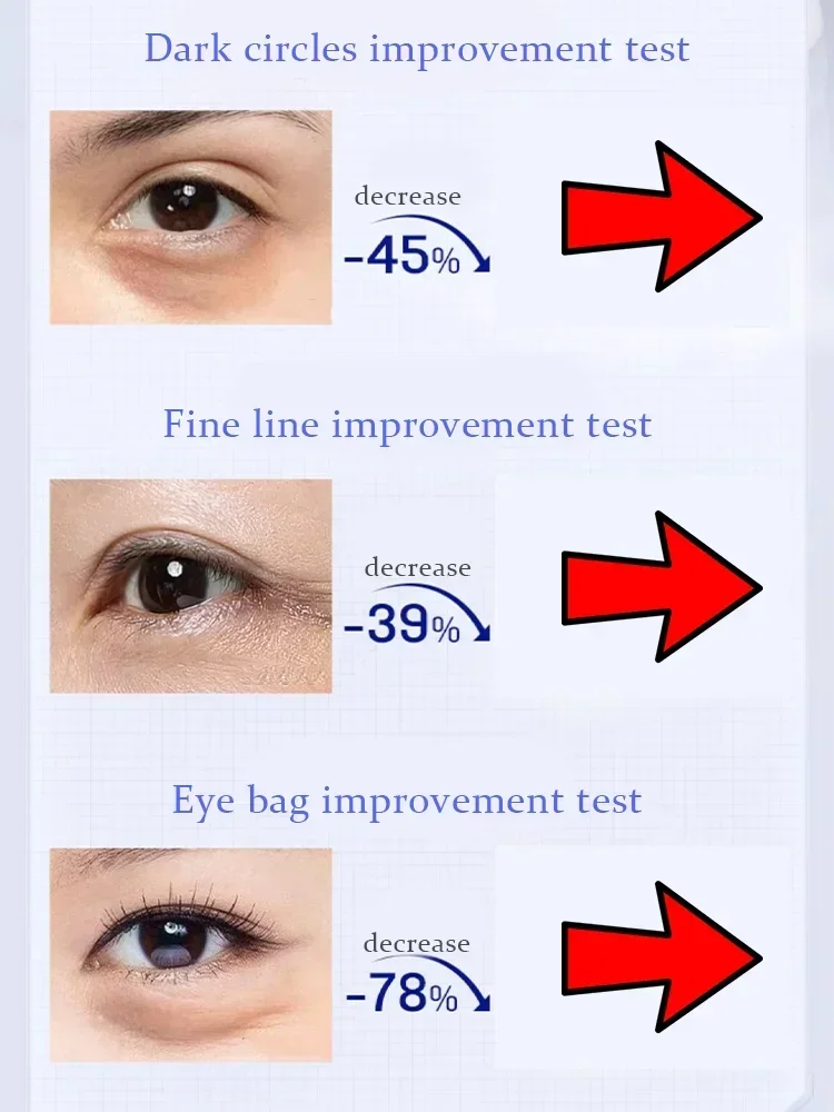 Крем для области вокруг глаз подтягивающий укрепляющий удаляет отеки и морщины