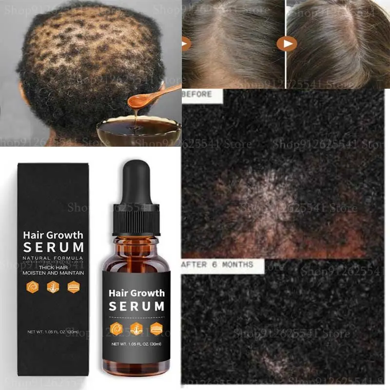 

30ml Hair Growth Essential Oil Hair Loss Treatment Regrow Your Edges Bald Spots Thinnin Hair Growth Products Anti-Hair Loss