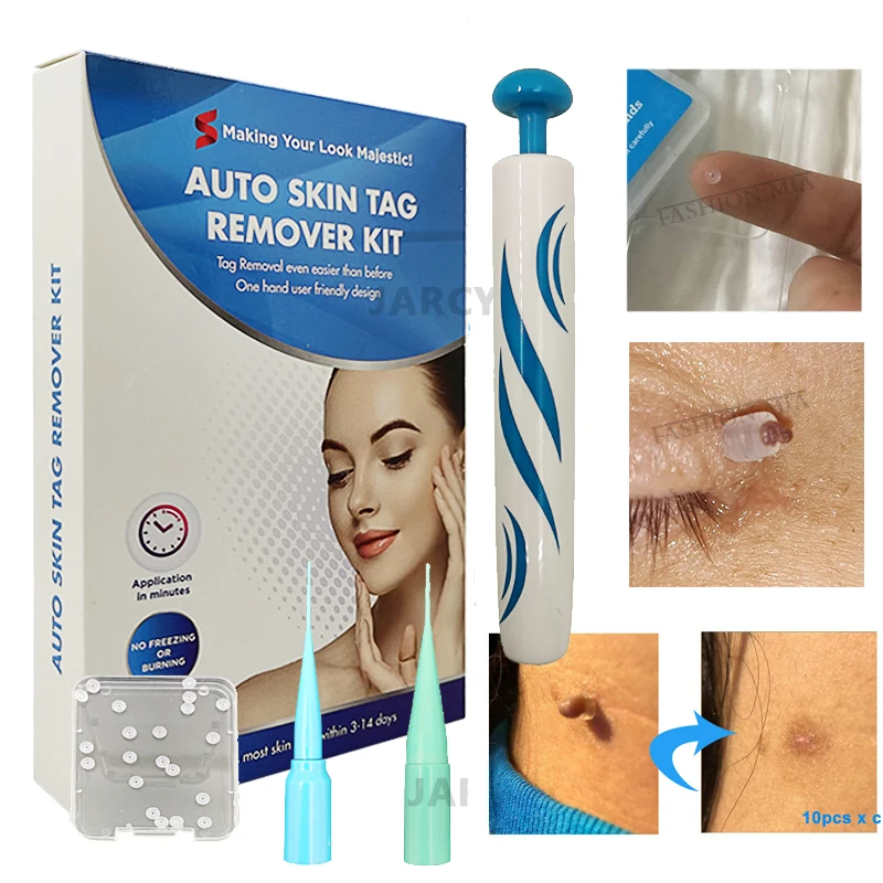 

Skin Tag Remover Tool Auto Papilloma Removal Kit Micro Beard removal To Remover Wart Spot Remover Mole Remover Skin Care Band