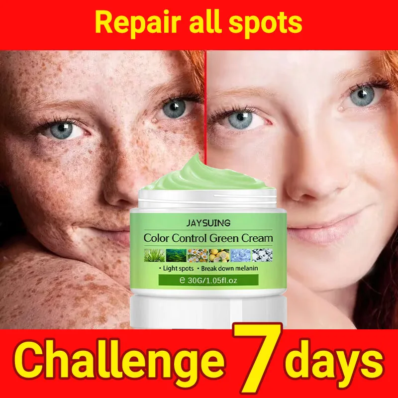 Whitening Freckles Cream Remove Dark Spots Melasma Fade Melanin Cream Anti-Aging Moisturizing Brightening Face Skin Beauty Care