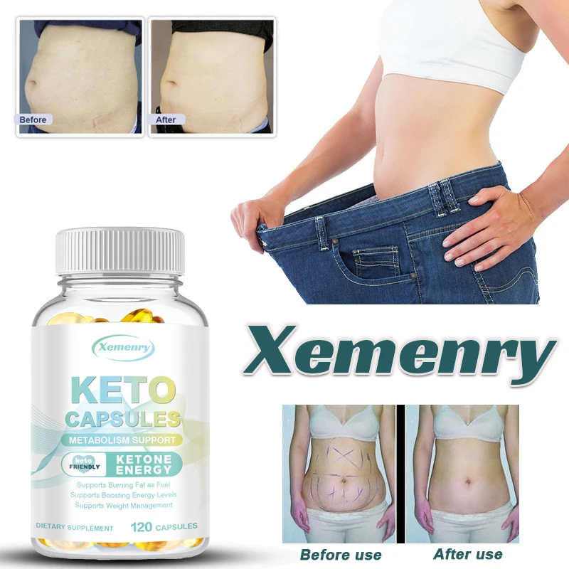 

Xemenry Ketogenic Weight Loss Capsules, Enhance Immune System, Enzyme Detoxification, Promote Metabolism, Suppress Appetite