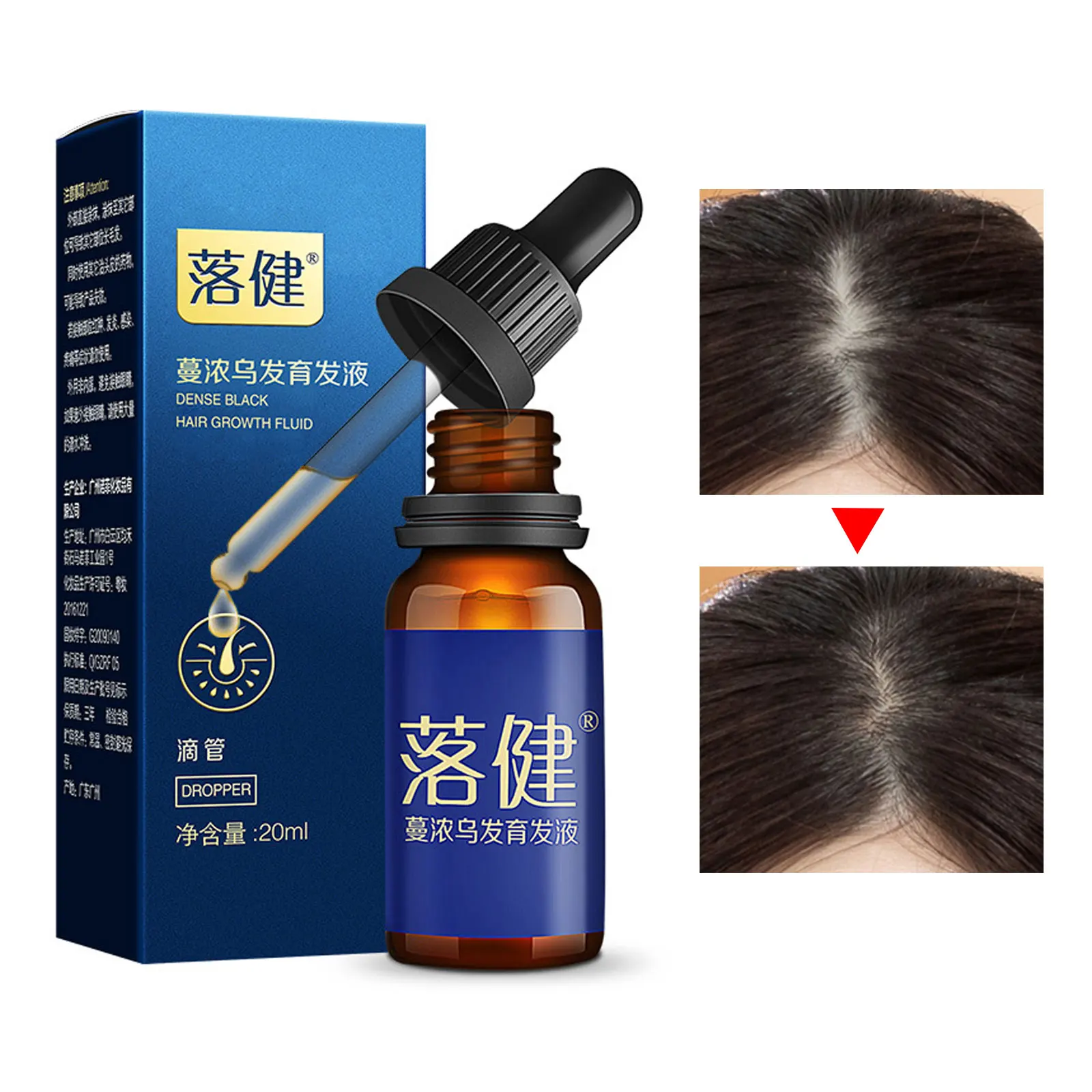 

Fast Hair Growth Essence Liquid Hair Regeneration Serum Anti-hair Loss Hair Care Product Thicken Full Hair Strengthen Hair Roots