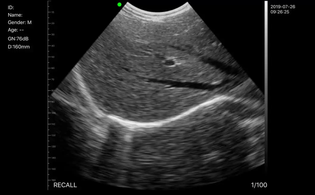 

Konted C10R 2020 Портативный Беспроводной ультразвуковой сканер Conevx зонд 3,5 МГц инновационные медицинские устройства