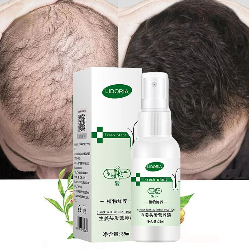 Powerful Hair Growth Serum Spray Natural Anti Hair Loss Essence Oil Repair Nourish Hair Roots Fast Regrowth Hair Care Men Women