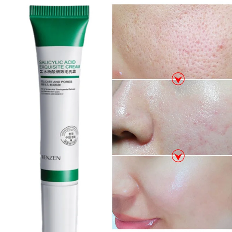 

20gSalicylic Acid Pore Refinement Cream Pore Refinement Cream Blackhead Removal Moisturizing Refreshing Cream Skin Care Products