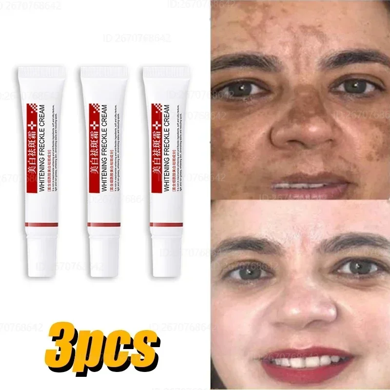 Эффективный точечный крем быстрое отбеливание удаление мелазмы на лице мелазма