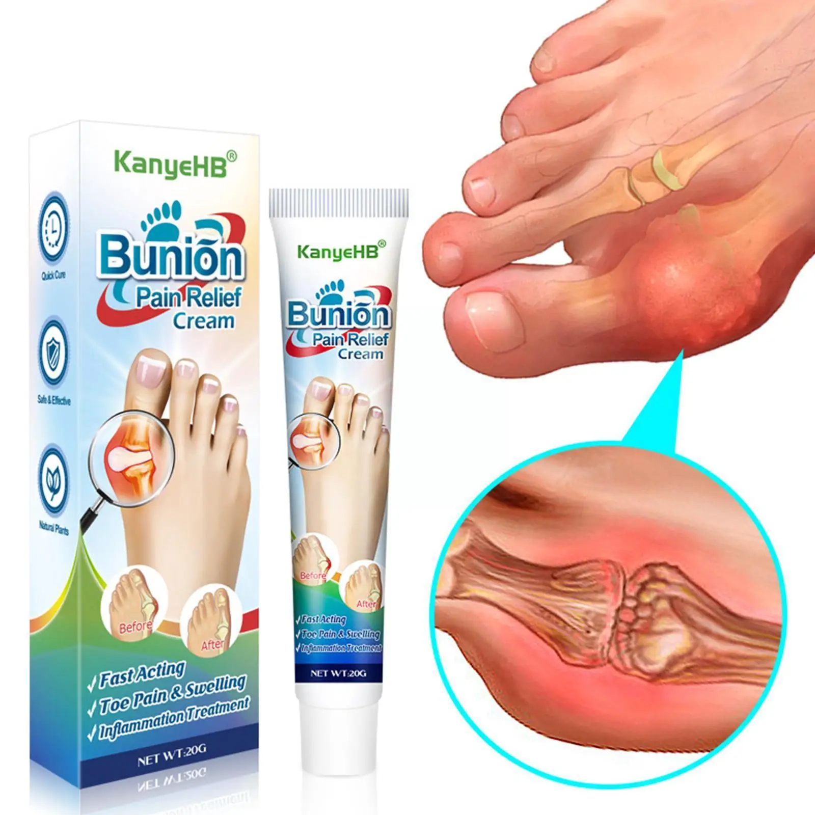 

1pc Bunion Treatment Ointment Toe Joint Pain Relief Gout Stiffness Treat Cream 20g Arching Limb Anti-infl Pain I0k4