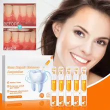 Gum Repair Treatment Ampoules Oral Care Essence Cleaning Breath Toothache Remove Fresh Liquid Relief Swelling Gums Gingiva Z4A4
