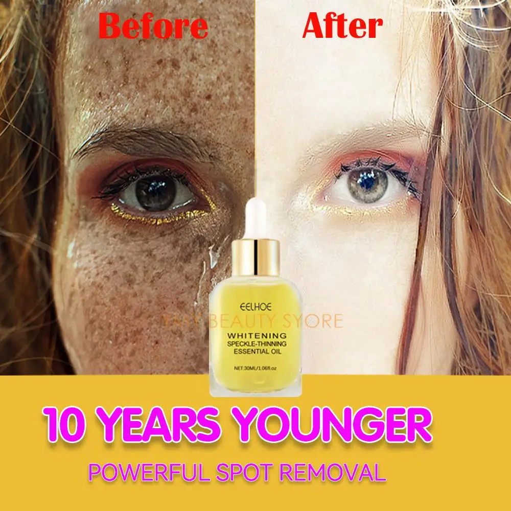 

Dark Spot Remover Melasma Whitening Serum Facial Care Essence Oil Brighten Skin Lightening Dullness Fade Freckle Pigment Melanin
