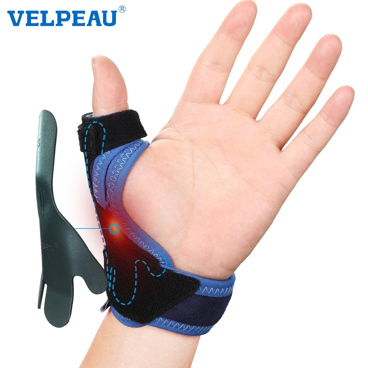 VELPEAU Thumb Splint with Wrist Support Thumb Brace for Tenosynovitis Pain Relief Octopus-Shaped Plate Fits The Thumb Universal