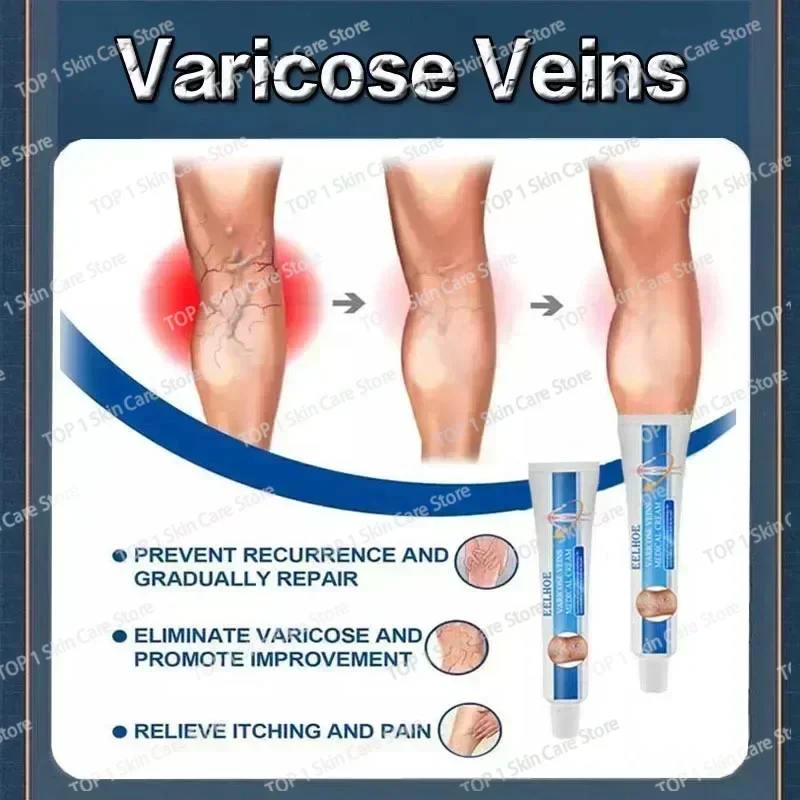 Восстанавливающий крем от варикозного расширения вен Tongmai эффективное