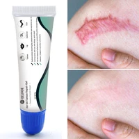 scar repair cream remove stretch marks burn surgical scars promote cell regeneration anti allergic smooth body skin care