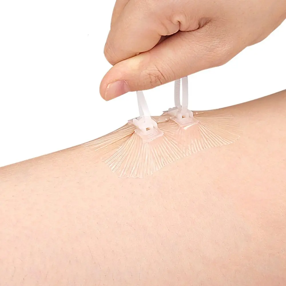 Клейкая повязка на молнии для ухода за ранами помощь при первой помощи ремонт без