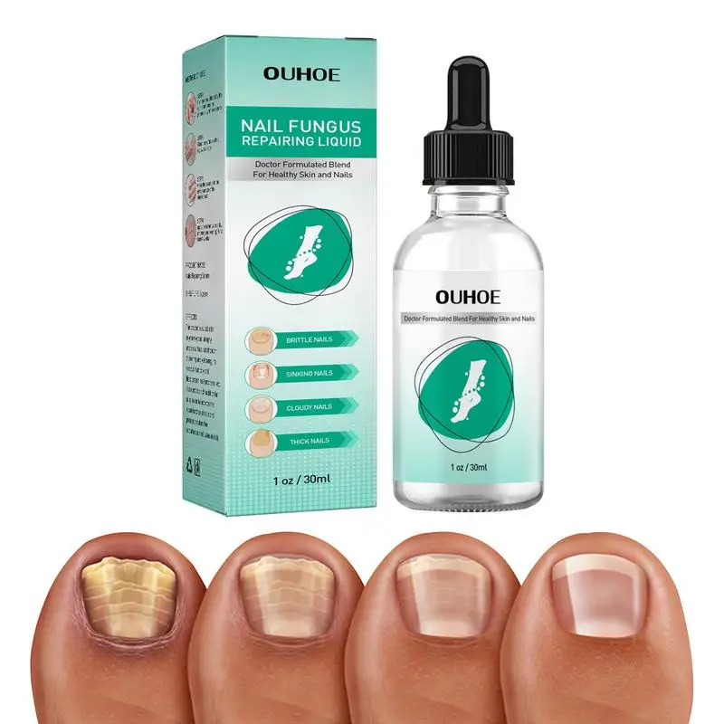 Solution gel. Средство для лечения ногтей. Нафтифин 20 мл. Жидкость для снятия гель лака. Cosmake жидкость для полигеля slip solution (16 мл).