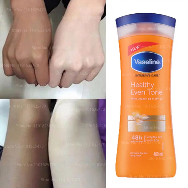 

Вазелиновое молоко для тела, Ниацинамид, молоко для тела, осень и зима, улучшает огрубевшую кожу курицы, молоко для тела, 400 мл