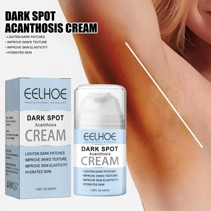 

Осветляющий крем для подмышек, многофункциональный уход за кожей, темные пятна, выцветание, меланин, солнечные ожоги, колени, темнота для девочек