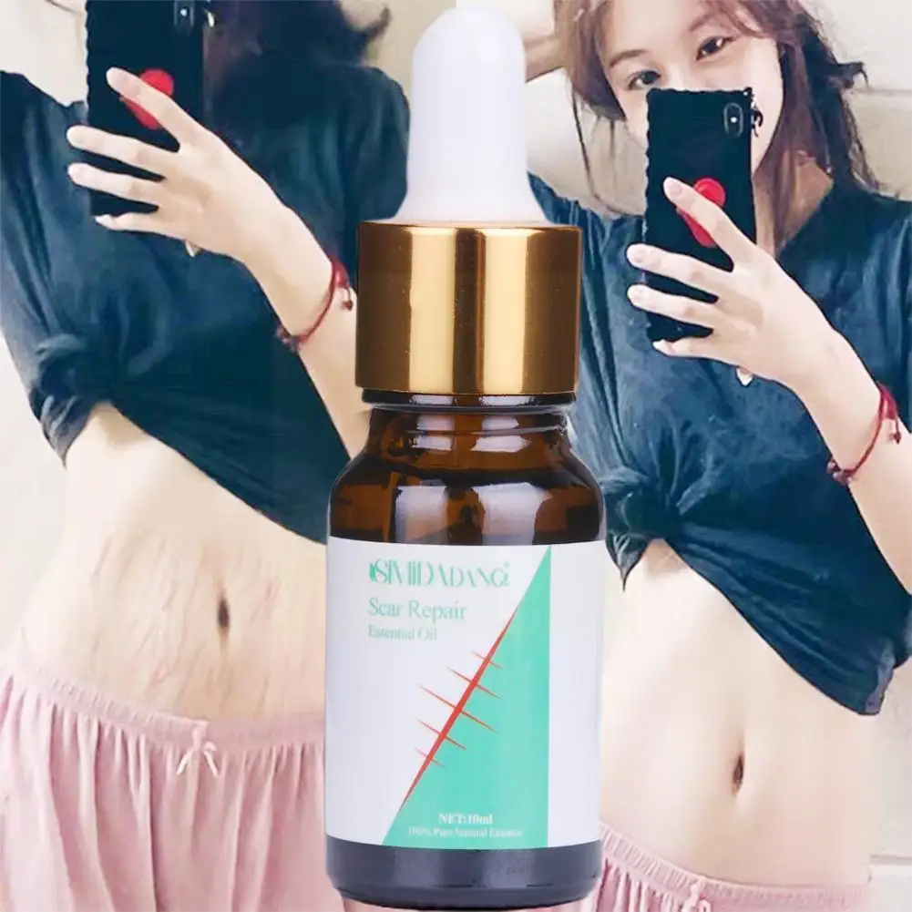 

1oml Lavender Essence Scar Repair Skin Essential Oil Ance Marks Pure Sreum Remove Strentch Removal Burn Natural Scar U7c6