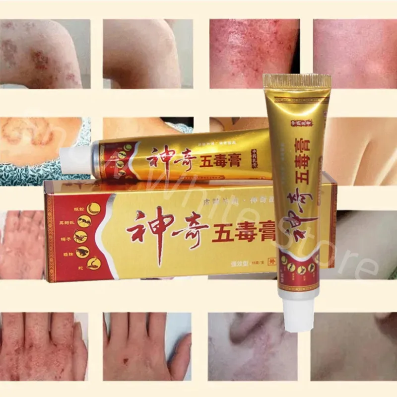

60pcs Useful Psoriasis Cream Psoriasis Ointment Dermatitis Eczematoid Eczema Ointment Skin Treatment Skin repair cream zudaifu